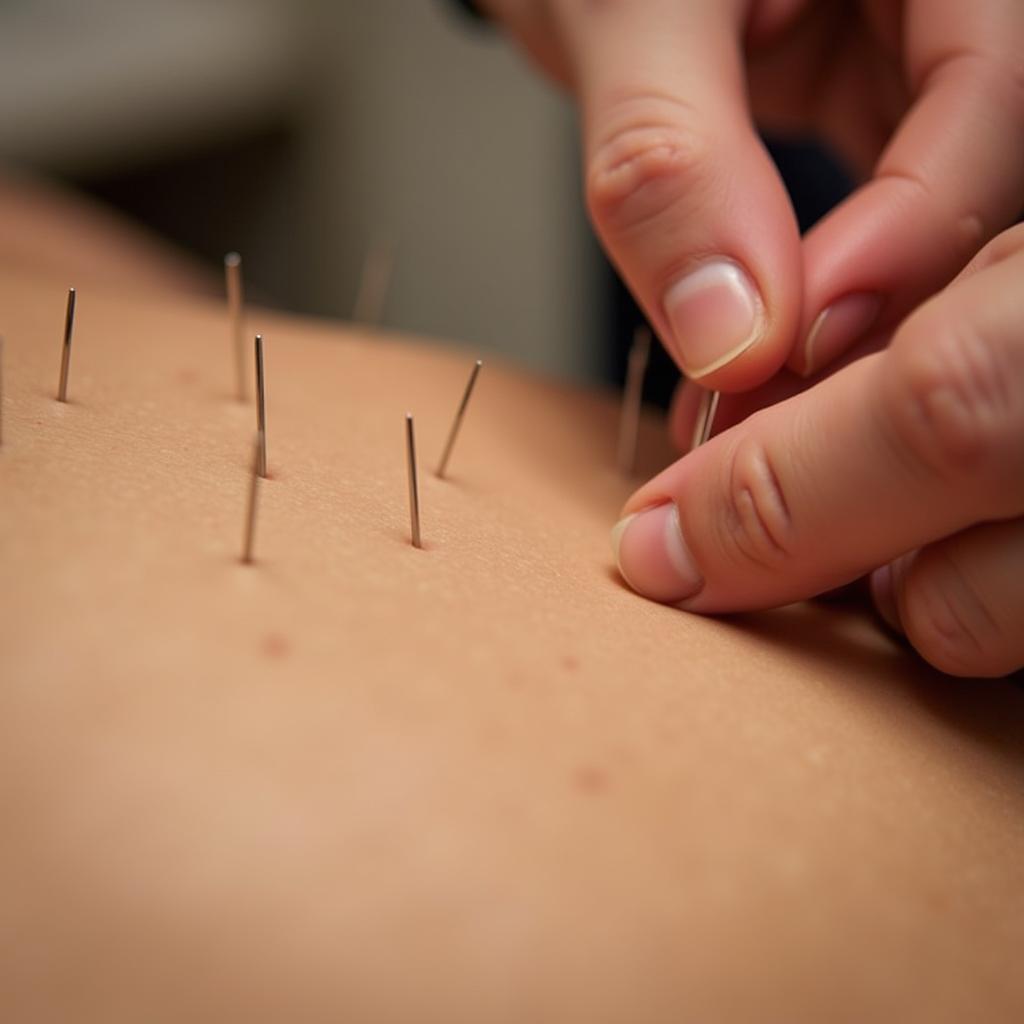 Acupuncture Treatment in Progress