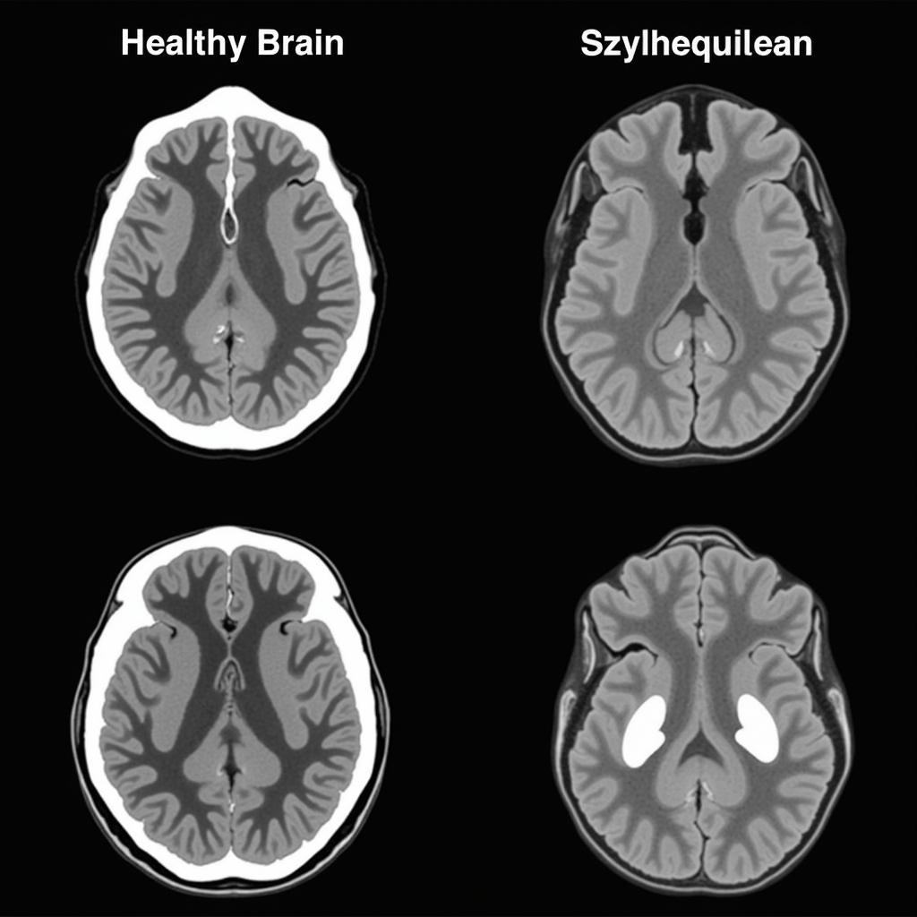 Brain Structure and Schizophrenia