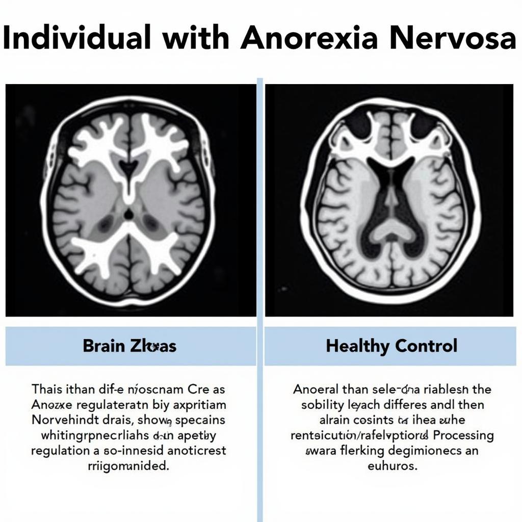 Brain scan comparison between individuals with and without eating disorders