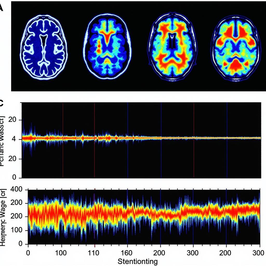 Edge Sound Brain Activity