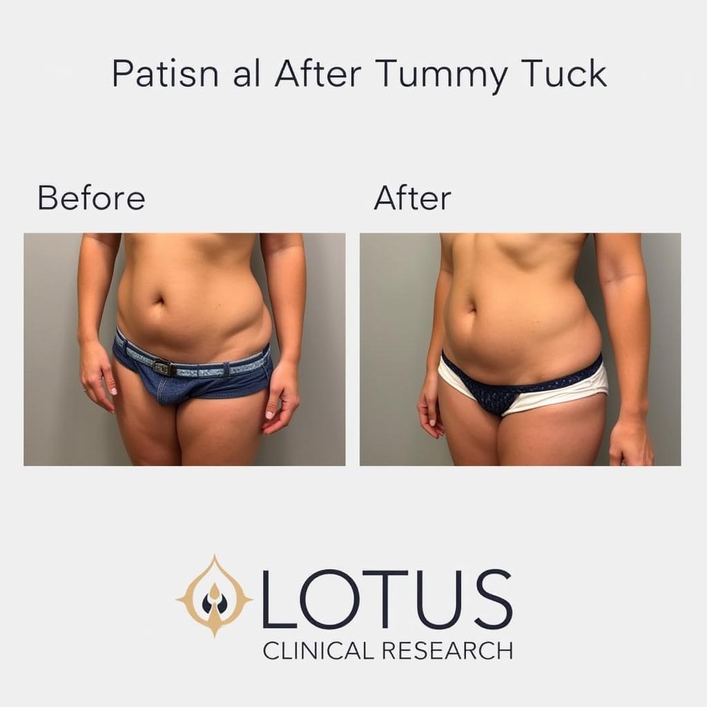 Lotus Clinical Research Tummy Tuck Results